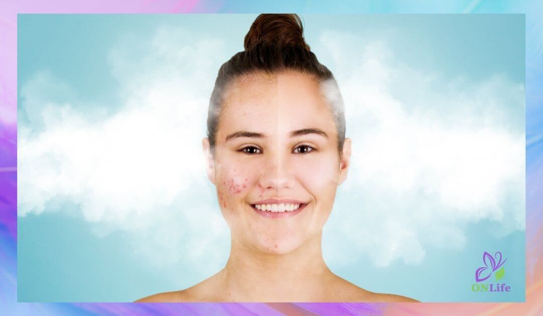 Криотерапия за лице у дома