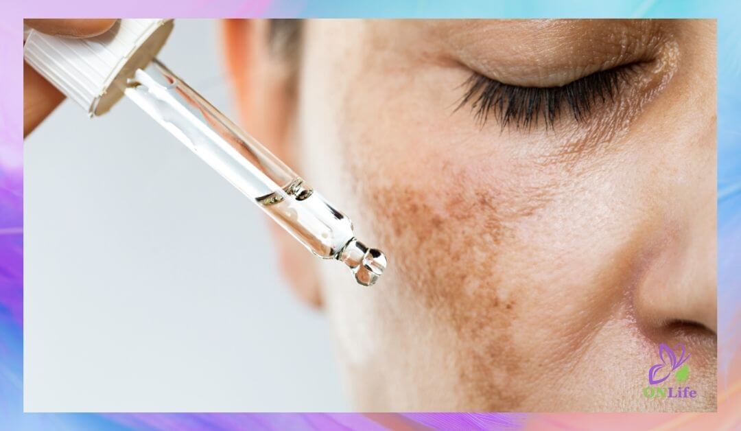 Лесни 15-минутни домашни маски за пигментни петна